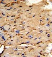 PEA15 antibody, C-term