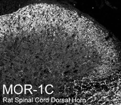 Mu Opioid receptor splice variant antibody
