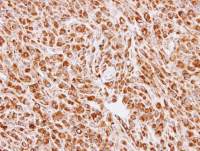 Calreticulin 3 antibody