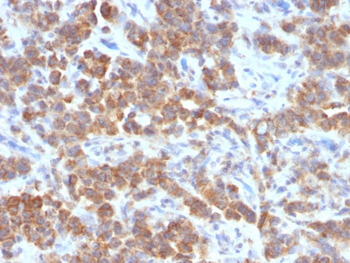 TL1A antibody [VEGI/1283]