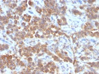 TL1A antibody [VEGI/1283]