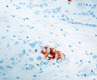 Alpha fetoprotein / AFP antibody [C3]