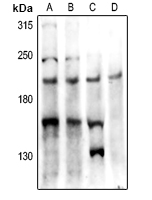 PTP kappa antibody