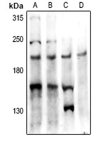 PTP kappa antibody
