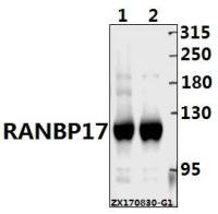 RanBP17 antibody