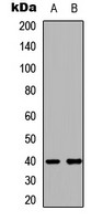 LMTK3 antibody