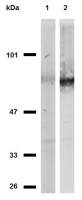 CD44 antibody [MEM-263]