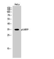 RNF144B antibody