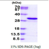 Human Adenylate kinase 4 protein, His tag