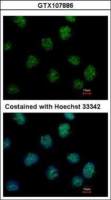 IP6K2 antibody