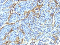 p75 NGF Receptor / CD271 antibody [NTR/912]