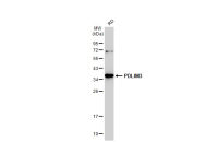 ALP / PDLIM3 antibody [C2C3], C-term