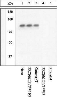 PKC beta (phospho Thr500) antibody