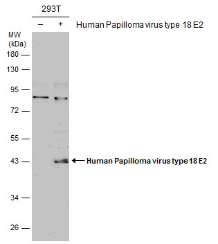Human Papillomavirus type 18 E2 antibody