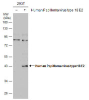 Human Papillomavirus type 18 E2 antibody