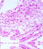 Nuclear Fast Red counterstain