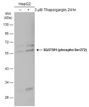 SQSTM1 / P62 (phospho Ser272) antibody