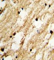 DCC1 antibody, N-term