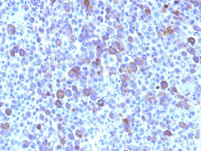 Glypican-3 antibody [SPM595]
