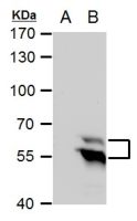TdT antibody [C1C3]