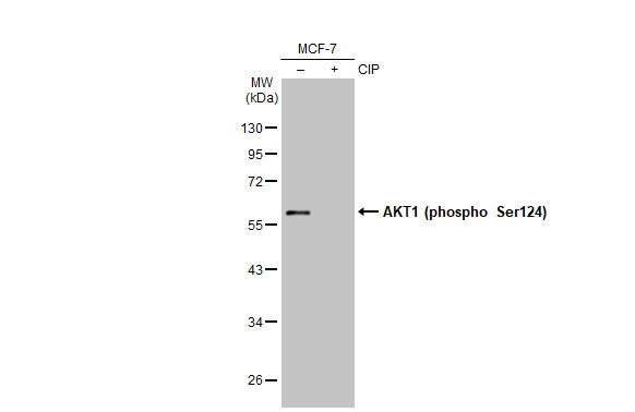 AKT1 (phospho Ser124) antibody [GT1268]