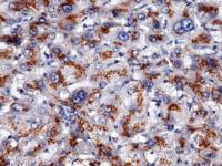 Apolipoprotein H antibody [003]