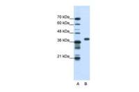 PCBP1 antibody, Internal