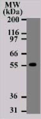 DR4 antibody [32A1380]