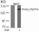 PLCG2 (phospho Tyr753) antibody