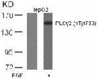 PLCG2 (phospho Tyr753) antibody