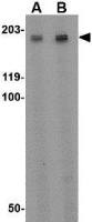 GPR124 antibody