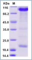 Human PCSK9 protein, mouse IgG1 Fc tag