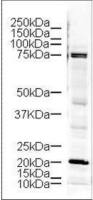 LIMK1 antibody