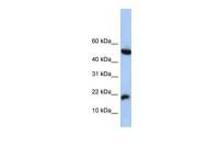 LOC285033 antibody, N-term