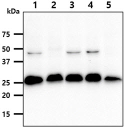 SSU72 antibody [AT45E2]