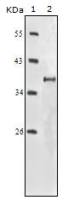 IGF1R antibody [3C8B1]