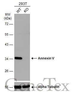 Annexin V antibody [N2C3]