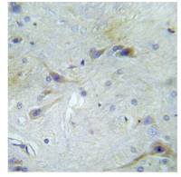 APP (phospho Thr743/Thr668) antibody