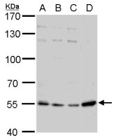 Visfatin antibody [N1N3]