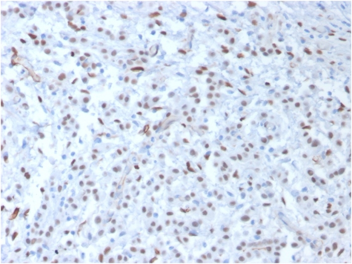 Wilms Tumor 1 antibody [WT1/857]