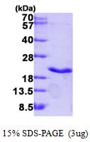 Human TNF beta protein, His tag (active)