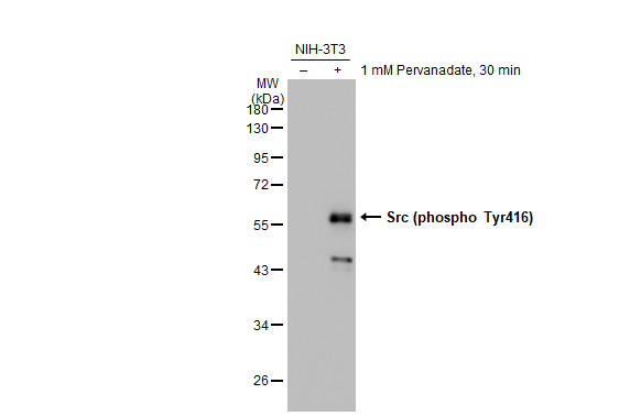 Src (phospho Tyr416) antibody [GT1314]