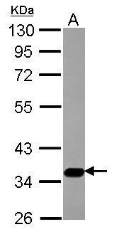 SLC17A5 antibody
