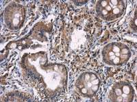 iNOS antibody [N1N2-2], N-term