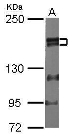 ZNF198 antibody