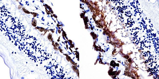 S-arrestin antibody [PDS1]