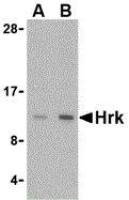 Hrk antibody