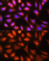 Ferritin Light Chain antibody
