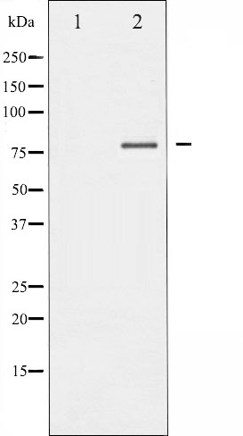 FOXO1 (phosphoThr24) + FOXO3a (phospho Thr32) + FOXO4 (phospho Thr28) antibody