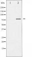 FOXO1 (phosphoThr24) + FOXO3a (phospho Thr32) + FOXO4 (phospho Thr28) antibody